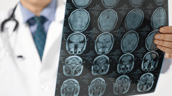 Male doctor examining head scan